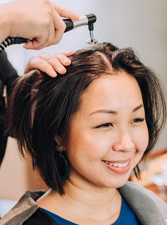 Treatments for Hair Loss