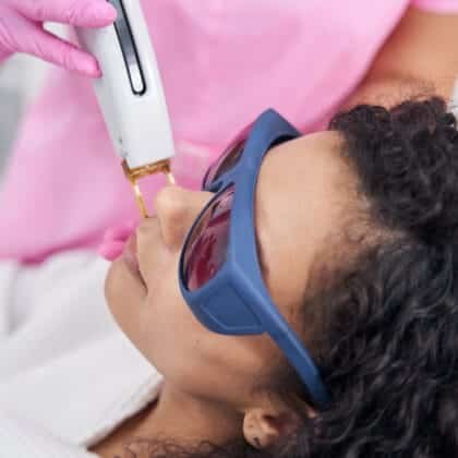 facial-hair-removal-treatment