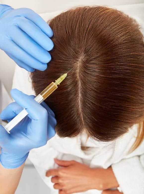 best PRP hair treatment in Chennai