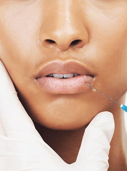 best dermal filler treatment in Nungambakkam