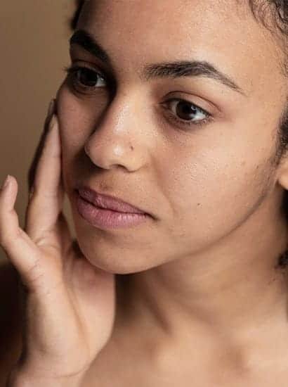 Best Skin Pigmentation Treatment in Chennai