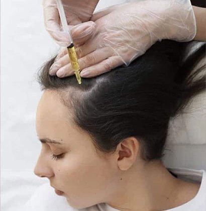 growth factor concentrate treatment for hair loss