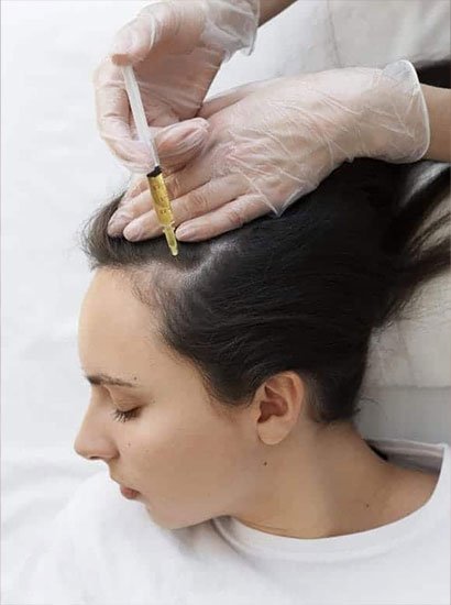 growth factor concentrate treatment for hair loss