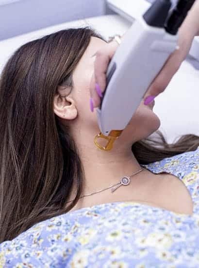 laser facial hair removal treatment