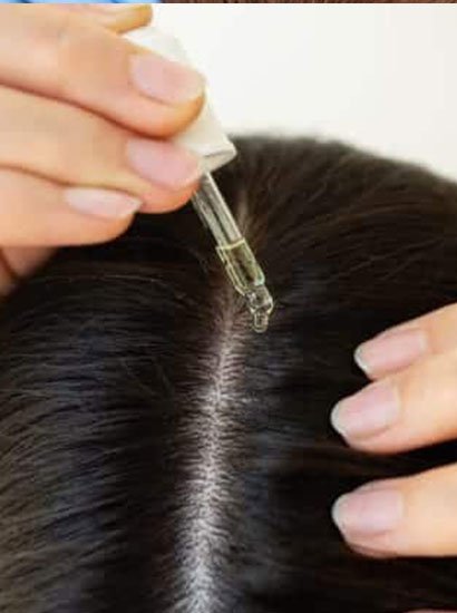hair loss treatment in chennai